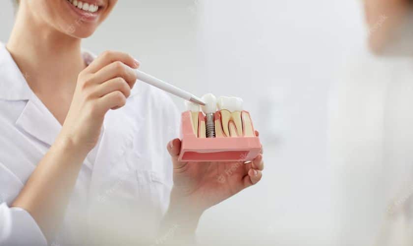 Featured image for “5 Steps To Speed Up Recovery After Dental Implant Surgery”