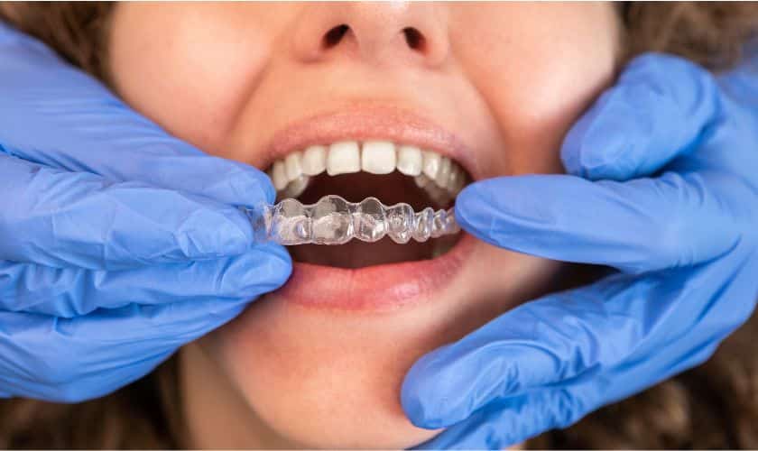 Featured image for “Maintaining Oral Health While Using Invisalign in Robstown: Tips and Tricks”