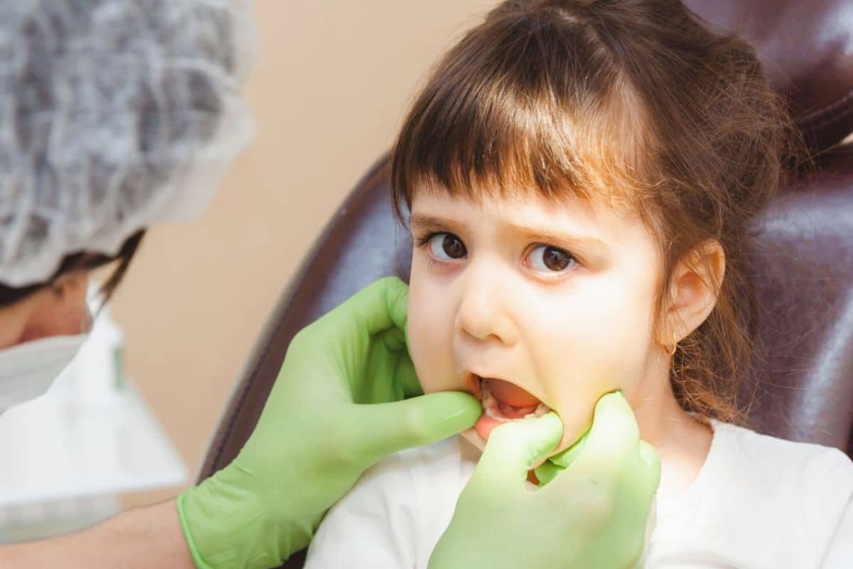 Child Keep Getting Cavities Despite Brushing